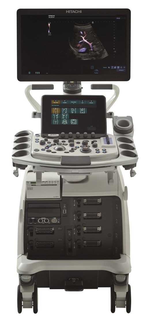 Aparat ultrasonograficzny Hitachi Aloka Arietta 850